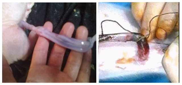 ĸ����Ѫ�������Ӽ�����ѪЧ��